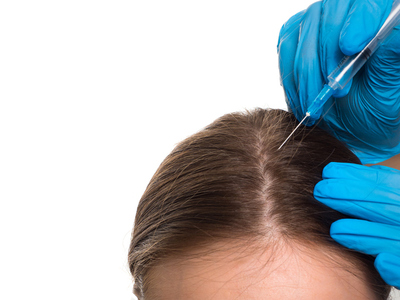 Provider treating patient for hair loss