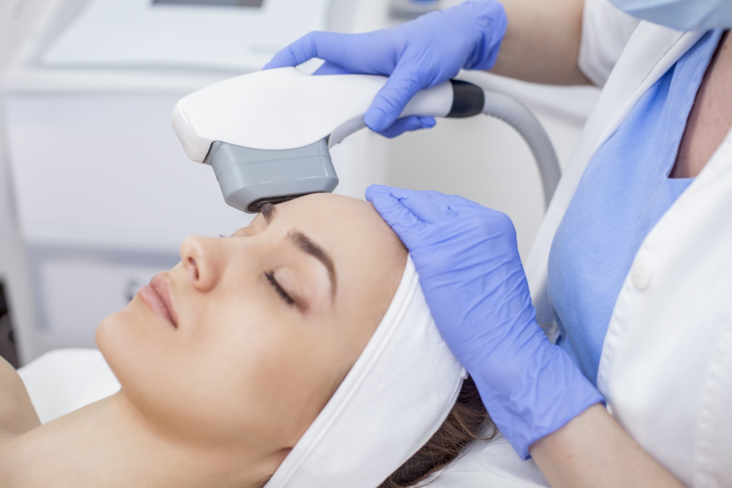 Laser Treatment for Sunspots