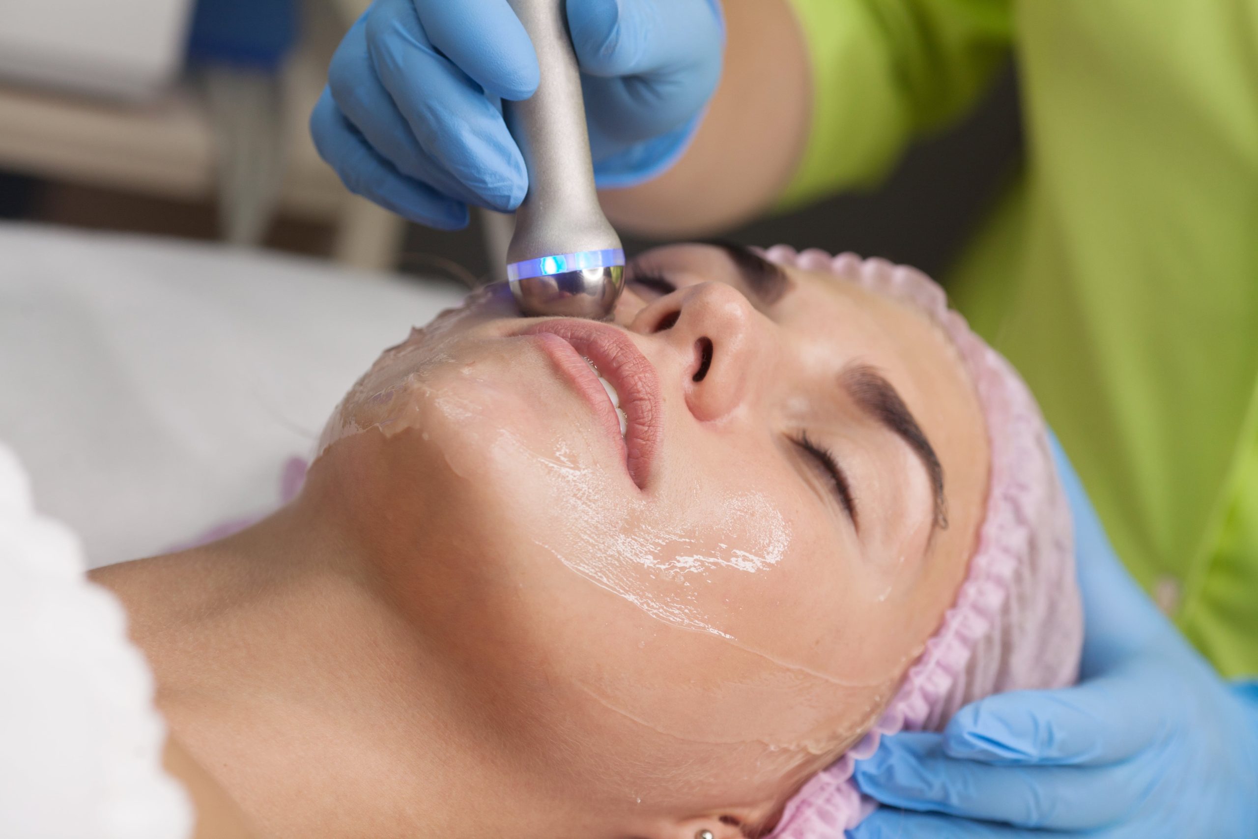 Laser-Treatments-for-Fine Lines-Wrinkles