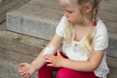 Pediatric Eczema